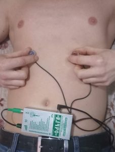 Электростимуляция прибором Ольга